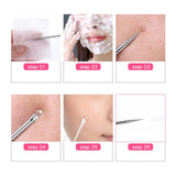 Flytonn- 1 Pcs Blackhead Comedone Acne Pimple Blemish Extractor Remover Stainless Steel Needles Remove Tools Face Skin Care Pore Cleaner