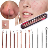 Flytonn- Blackhead Comedone Acne Needle Remover Tool Kit Clip Pimple Spoon for Face Skin Care Tool Needles Facial Pore Cleaner